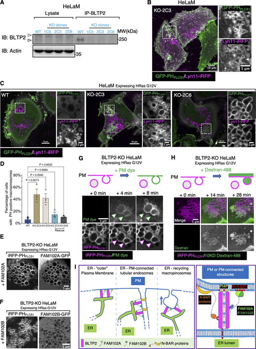 BLTP2-KO cells show accumulation of intracellular PI(4,5)P2-positive vacuoles. (A) Western blot validating knockout (KO) of BLTP2 in HeLaM cells. Endogenous BLTP2 is enriched using IP before detection. Three independent KO clones are verified. (B) BLTP2-KO HeLaM cells showing presence of PI(4,5)P2-positive intracellular vacuoles. Tubular recycling endosomes are still present in these cells. (C and D) Expression of HRas G12V in HeLaM cells (two independent clones: KO-2C3 and KO-2C6) induces formation of macropinosomes/intracellular vacuoles in both WT and BLTP2-KO cells. However, only in the KO cells a large fraction of these vesicles remain PI(4,5)P2 positive. Quantification of PI(4,5)P2-positive macropinosomes is shown in D. One-way ANOVA. Mean ± SEM. n = 3 independent experiments. 123 cells for WT, 137 cells for KO-2C3, 161 cells for KO-2C6, 119 cells for KO-2C3 rescue, and 122 cells for KO-2C6 rescue. (E and F) BLTP2-KO cells expressing HRas G12V together with FAM102A-GFP (E) or FAM102B-GFP (F). FAM102A-GFP, but not FAM102B-GFP, is enriched on PHPLCδ1-labeled PI(4,5)P2-positive macropinosomes. (G and H) PM dye (G), or 10 KD dextran-488 (H) was added to BLTP2-KO cells expressing HRas G12V. A fraction of the preexisting PI(4,5)P2-positive vacuoles were labeled by the dye within minutes after PM dye addition (G), showing internalization of dextran-488 (H). (I) Schematic model of BLTP2 localization at contacts of the ER with PM and PM-connected structures (left). Illustration of the molecular interaction of BLTP2 with phosphoinositides and its binding proteins (FAM102A/B, N-BAR domain proteins) at these contact sites (right). Source data are available for this figure: SourceData F8.