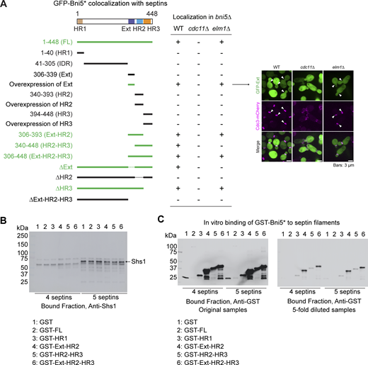Identification of septin- and Elm1-dependent localization domains in Bni5 and Western blot confirmation of Bni5 fragment interactions with four- and five-septin complexes. Related to Fig. 3. (A) Colocalization analysis of various Bni5 fragments with septins. Imaging was performed in bni5Δ, bni5Δcdc11Δ, and bni5Δelm1Δ strain backgrounds. Colocalization between GFP-tagged Bni5 fragments and Cdc3-mCherry is indicated in a table as “+” (colocalization) or “−” (no colocalization). Fragments exhibiting colocalization in at least one strain background are highlighted in green. Bold and dashed lines indicate the presence and absence of specific regions in the corresponding Bni5 variants, respectively. For overexpression of Ext, HR2, and HR3 fragments, cells were grown in methionine-depleted SC medium for 5 h; representative images of Ext-overexpressed cells were shown beside the table. Asterisk indicates Bni5 variants. Plasmids from the pUG36-Bni5* series (Table S2) were introduced into the following strains: YEF10994 (bni5∆ CDC3-mCherry), YEF12138 (bni5∆ cdc11Δ CDC3-mCherry), and YEF11277 (bni5∆ elm1∆ CDC3-mCherry). (B) Western blot analysis using an anti-Shs1 antibody confirms the presence of Shs1 in the five-septin, but not in the four-septin, complexes used in our in vitro binding experiments. (C) Western blots using an anti-GST antibody to demonstrate the ability of different Bni5 fragments to bind septin filaments in vitro. Due to inefficient transfer of large-sized proteins from polyacrylamide gel to PVDF membrane, the GST-FL (Bni5) could be observed only when more samples were loaded for the western blot analysis (left). Source data are available for this figure: SourceData FS2. Refer to the image caption for details.