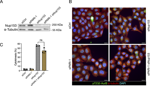 PARI does not stabilize the midbody upon NPC defects. (A) Western blot showing partial depletion of NUP153. Membrane probed with a NUP153 antibody and alpha-tubulin as a loading control. (B) Cells transfected with siCtrl, siNUP153, siPARI-1, and a combination of siPARI-1 + siNUP153. Cells were synchronized with thymidine for 24 h, released for 16 h, and fixed. Scale bars: 10 µm. (C) Quantification of the fraction of cells showing midbodies (% cytokinesis). Mean and SD are shown. Student’s paired t test, P > 0.05 = ns (n > 789, N = 3). NPC, nuclear pore complex. Source data are available for this figure: SourceData F8.