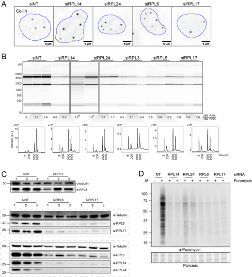 Large ribosomal protein depletion leads to increased CB number, impaired ribosomal biogenesis and translation inhibition. (A) Immunofluorescent images showing coilin signal in HeLa cells after siRNA knockdown of control or ribosomal proteins for 72 h. The nucleus outline is shown in blue. (B) Electropherograms of total RNA isolated from HeLa cells after respective siRNA knockdown. 28S/18S rRNA intensity ratio is listed below each lane, and a representative electropherogram in arbitrary intensity unit is shown for each siRNA. (*) marks sample reruns. (C) WB of HeLa cell lysate harvested after respective siRNA knockdown. Tubulin was used as the loading control. Numbers 1–3 stand for independent replicates. (D) WB of puromycin incorporation assay. HeLa cell was treated with the siRNA of control or ribosomal proteins for 72 h, followed by incubation with or without 1 μM puromycin for 1 h before harvest. “−” indicates no puromycin control, “+” indicates puromycin addition. Ponceau stain was shown as the loading control. Two replicates are shown for each RPL knockdown condition. Source data are available for this figure: SourceData FS4. Refer to the image caption for details.