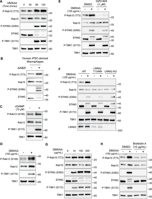 STING-dependent activation of LRRK2 kinase activity. (A) Immunoblots illustrating the time course of responses to treatment with 100 µg/ml DMXAA. (B) Immunoblots from human iPSC-derived macrophages treated for 2 h with 2.5 µM diABZI. (C and D) Immunoblots showing the impact of STING activation for 2 h with cGAMP and DMXAA on Rab12 phosphorylation (P-TBK1 is a control for STING activation). (E) Immunoblots from cells incubated for 2 h ± DMXAA and ± GZD-824 (LRRK2 inhibitor, treatment started 1 h before addition of DMXAA). (F) Immunoblots demonstrating the effects of STING activation with DMXAA in WT, LRRK2 T1348N knockin, and LRRK2 KO RAW 264.7 cells. (G) Immunoblots showing the concentration dependence of responses to STING activation with DMXAA. (H) Immunoblots from cells treated with the indicated concentrations of DMXAA (2 h) and brefeldin A (treatment started 1 h before addition of DMXAA). Molecular weight markers (kDa) are indicated on the right side of each blot. All experiments apart from S1D were conducted in RAW 264.7 cells. Data presented in this figure are representative of results from a minimum of three independent experiments. Source data are available for this figure: SourceData FS1.