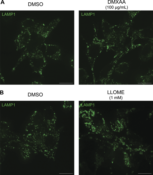 Morphology of lysosomes treated with DMXAA and LLOME. (A) Spinning disk confocal immunofluorescence microscopy analysis of lysosome morphology (LAMP1) of WT RAW 264.7 cells treated with the STING agonist DMXAA (100 µg/ml for 2 h). (B) Spinning disk confocal immunofluorescence microscopy analysis of lysosome morphology (LAMP1) of WT RAW 264.7 cells treated with LLOME (1 mM for 2 h). The scale bars are 10 µm. Data presented in this figure are representative of results from a minimum of three independent experiments. Source data are available for this figure: SourceData FS2. Refer to the image caption for details.