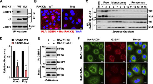 Site-specific MARylation of RACK1 is required for stress granule assembly. (A and B) Loss of RACK1 MARylation inhibits RACK1 interaction with G3BP1. (A) HA-tagged RACK1 was immunoprecipitated (IP) from OVCAR3 cells with Dox-induced knockdown of endogenous RACK1 and re-expression of exogenous RACK1. The immunoprecipitates were subjected to immunoblotting for G3BP1 and HA. The sizes of molecular mass markers in kDa are shown. (B) PLA using G3BP1 and HA antibodies. DNA was stained with DAPI. Scale bar is 15 µm. (C and D) Loss of RACK1 MARylation inhibits the recruitment of G3BP1 to ribosomes. (C) Immunoblot analysis for HA-tagged RACK1 and G3BP1 in sucrose density gradient fractions of ribosomes prepared from OVCAR3 cells subjected to Dox-induced knockdown of endogenous RACK1 and re-expression of exogenous RACK1. The sizes of molecular mass markers in kDa are shown. Each bar in the graph in D represents the mean + SEM of the relative abundance of G3BP1 in monosomes or polysomes (n = 3, two-way ANOVA, *P < 0.05 and **P < 0.01). (E and F) Loss of RACK1 MARylation inhibits G3BP1 localization to stress granules and its interaction with translation factors that are key components of stress granules. (E) G3BP1 was immunoprecipitated from OVCAR3 cells with Dox-induced knockdown of endogenous RACK1 and re-expression of exogenous RACK1. The immunoprecipitates were subjected to immunoblotting for eIF3η, RPS6, and G3BP1 as indicated. The sizes of molecular mass markers in kDa are shown. (F) Immunofluorescent staining assays of OVCAR3 cells with Dox-induced knockdown of endogenous RACK1 and re-expression of exogenous RACK1 subjected to 15 min of treatment with 250 µM sodium arsenite (NaAsO2). Staining for HA (RACK1) and G3BP1. DNA was stained with DAPI. Scale bar is 15 µm. Source data are available for this figure: SourceData F2. Refer to the image caption for details.