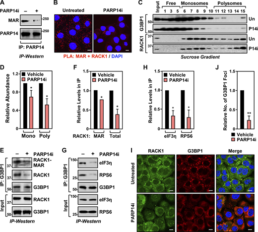 PARP14 inhibition reduces stress granule assembly. (A) PARP14i blocks PARP14 autoMARylation. OVCAR3 cells were treated with 10 µM PARP14i (RBN012759) for 24 h. PARP14 was immunoprecipitated (IP) and subjected to immunoblotting for PARP14 and MAR. The size of a molecular mass marker in kDa is shown. (B) Inhibition of PARP14 catalytic activity blocks RACK1 MARylation. PLA using MAR and RACK1 antibodies in OVCAR3 cells treated with 10 µM PARP14i (RBN012759) for 24 h. DNA was stained with DAPI. Scale bar is 15 µm. (C and D) PARP14 inhibition reduces the recruitment of G3BP1 to ribosomes. (C) Immunoblot analysis of RACK1 and G3BP1 in sucrose density gradient fractions of ribosomes prepared from OVCAR3 cells treated with 10 µM PARP14i for 24 h. The sizes of molecular mass markers in kDa are shown. Each bar in the graph in D represents the mean + SEM of the relative abundance of G3BP1 in monosomes or polysomes (n = 3, two-way ANOVA, *P < 0.05). (E and F) PARP14 inhibition reduces G3BP1 interaction with RACK1. (E) G3BP1 was immunoprecipitated from OVCAR3 cells treated with 10 µM PARP14i for 24 h and subjected to immunoblotting for MAR, RACK1, and G3BP1 as indicated. The band corresponding to the molecular weight of RACK1 was indicated as MARylated RACK1. The sizes of molecular mass markers in kDa are shown. Each bar in the graph in F represents the mean + SEM of the relative abundance of total RACK1 or MARylated RACK1 in G3BP1 immunoprecipitates (n = 3, Student’s t test, two-tailed, *P < 0.05). (G and H) PARP14 inhibition reduces G3BP1 interaction with translation factors that are key components of stress granules. (G) G3BP1 was immunoprecipitated from OVCAR3 cells treated with 10 µM PARP14i for 24 h and subjected to immunoblotting for eIF3η, RPS6, and G3BP1 as indicated. The sizes of molecular mass markers in kDa are shown. Each bar in the graph in H represents the mean + SEM of the relative abundance of eIF3η and RPS6 in G3BP1 immunoprecipitates (n = 3, multiple t test, *P < 0.05). (I and J) PARP14 inhibition reduces G3BP1 localization to stress granules. Immunofluorescent staining assays of OVCAR3 cells treated with 10 µM PARP14i for 24 h and subjected to 15 min of treatment with 250 µM sodium arsenite (NaAsO2). Staining for RACK1 and G3BP1. DNA was stained with DAPI. Scale bar is 15 µm. Each bar in the graph in J represents the mean + SEM of the relative abundance of stress granules (n = 3, Student’s t test, two-tailed, **P < 0.01). Source data are available for this figure: SourceData F3.