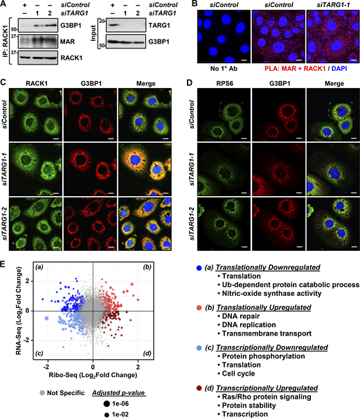 Depletion of TARG1 enhances stress granule assembly by increasing RACK1 MARylation. (A and B) siRNA-mediated TARG1 depletion increases RACK1 MARylation and enhances RACK1 interaction with G3BP1 in OVCAR3 cells subjected to 15 min of treatment with 250 µM sodium arsenite (NaAsO2). (A) RACK1 was immunoprecipitated (IP) from OVCAR3 cells with siRNA-mediated knockdown of TARG1 and subjected to immunoblotting for G3BP1, MAR, and RACK1. The sizes of molecular mass markers in kDa are shown. (B) PLA using MAR and RACK1 antibodies. DNA was stained with DAPI. Scale bar is 15 µm. (C and D) TARG1 knockdown increases the assembly of G3BP1-containing stress granules. Immunofluorescent staining assays of OVCAR3 cells with siRNA-mediated knockdown of TARG1 subjected to 15 min of treatment with 250 µM sodium arsenite (NaAsO2). (C) RACK1 and G3BP1, (D) RPS6 and G3BP1. DNA was stained with DAPI. Scale bar is 15 µm. (E) Changes in mRNA translation upon depletion of TARG1. Scatter plot of fold changes in ribosome profiling and RNA-seq (OVCAR3 cells subjected to siRNA-mediated TARG1 knockdown versus siControl) comparing translational control and transcriptional control. Gene ontology enrichment analysis of the mRNAs regulated at transcriptional and translational levels is shown. Source data are available for this figure: SourceData F5. Refer to the image caption for details.