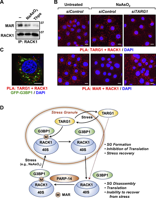 Prolonged exposure to stress reduces RACK1 MARylation. (A and B) Stress reduces RACK1 MARylation through TARG1. (A) RACK1 was immunoprecipitated (IP) from OVCAR3 cells treated with 250 µM sodium arsenite (NaAsO2) for 30 min or 250 nM thapsigargin (Thps) for 2 h, and subjected to immunoblotting for MAR and RACK1. The size of a molecular mass marker in kDa is shown. (B) PLA in OVCAR3 cells with siRNA-mediated knockdown of TARG1 using TARG1 and RACK1 (top) or MAR and RACK1 (bottom) antibodies. The cells were treated with sodium arsenite (NaAsO2) treatment for 30 min. DNA was stained with DAPI. Scale bar is 15 µm. (C) Knockdown of TARG1 increases the assembly of G3BP1-containing stress granules. PLA for TARG1 and RACK1 combined with immunofluorescent imaging of OVCAR3 cells expressing GFP-G3BP1 and treated with 250 µM sodium arsenite (NaAsO2) for 15 min. DNA was stained with DAPI. Scale bar is 15 µm. (D) Schematic of the mechanisms by which PARP14 and TARG1 regulate stress granule (SG) assembly through RACK1 MARylation. Additional details are provided in the text. Source data are available for this figure: SourceData F6.