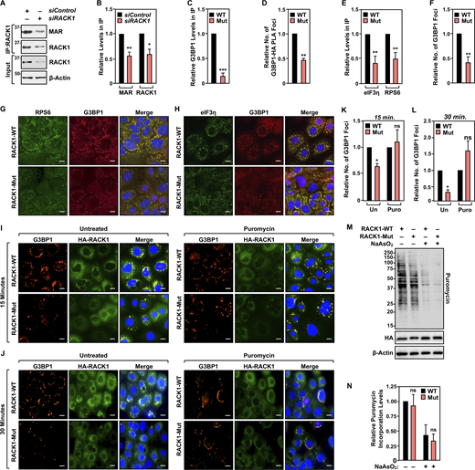 RACK1-Mut inhibits the formation of G3BP1 foci. (A and B) RACK1 is MARylated. Endogenous RACK1 was immunoprecipitated (IP) from OVCAR3 cells transfected with siRNAs targeting a control sequence or RACK1 and subjected to immunoblotting for MAR and RACK1. Each bar in B represents the mean + SEM of the levels of MARylated RACK1 and RACK1 in the immununoprecipitates of RACK1 (n = 3, Student’s t test, two-tailed, *P < 0.05 and **P < 0.01). (C) Quantification of multiple experiments like the one shown in Fig. 2 A. Each bar represents the mean + SEM of the relative abundance of G3BP1 in HA - RACK1 immunoprecipitates (n = 3, Student’s t test, two-tailed, ***P < 0.001). (D) Quantification of multiple experiments like the one shown in Fig. 2 B. Each bar represents the mean + SEM of G3BP1-HA (RACK1) PLA foci from two biological replicates (n = 2, Student’s t test, two-tailed, **P < 0.01). (E) Quantification of multiple experiments like the one shown in Fig. 2 E. Each bar represents the mean + SEM of the relative abundance of eIF3η and RPS6 in G3BP1 immunoprecipitates (n = 3, multiple t test, **P < 0.01). (F) Quantification of multiple experiments like the one shown in Fig. 2 F. Each bar represents the mean + SEM of distinct G3BP1 foci from three biological replicates (n = 3, Student’s t test, two-tailed, **P < 0.01). (G and H) Loss of RACK1 MARylation inhibits G3BP1 localization to stress granules and its interaction with translation factors that are key components of stress granules. Immunofluorescent staining assays of OVCAR3 cells with Dox-induced knockdown of endogenous RACK1 and re-expression of exogenous RACK1 subjected to 15 min of treatment with 250 µM sodium arsenite (NaAsO2). Staining for (G) RPS6 and G3BP1, (H) eIF3η and G3BP1. DNA was stained with DAPI. Scale bar is 15 µm. (I and J) RACK1 MARylation-mediated G3BP1 localization to stress granules is dependent on the levels of stalled polysomes. Immunofluorescent staining assays of OVCAR3 cells with Dox-induced knockdown of endogenous RACK1 and re-expression of exogenous RACK1 subjected to 15 min of treatment with 250 µM sodium arsenite (NaAsO2) (left, “Untreated”). The cells were also treated with 10 µg/ml puromycin for 15 min prior to 15 min (I) or 30 min (J) of treatment with 250 µM sodium arsenite (NaAsO2) (right, “Puromycin”). Staining for HA (HA-RACK1) and G3BP1. DNA was stained with DAPI. Scale bar is 15 µm. (K and L) Quantification of multiple experiments like those shown in (K) panel I above and (L) panel J above. Each bar represents the mean + SEM of distinct G3BP1 foci (n = 3, one-way ANOVA. *P < 0.05 and ns not significant). (M and N) RACK1-Mut expression does not alter global protein synthesis under stress in OVCAR3 cells. (M) Immunoblot analysis of puromycin incorporation assays from OVCAR3 cells subjected to Dox-induced knockdown of endogenous and re-expression of RACK1 followed by 15 min of treatment with 250 µM sodium arsenite. β-actin serves as a loading control. The sizes of molecular mass markers in kDa are shown. (N) Quantification of immunoblot experiments like those shown in M. Each bar in the graph represents the mean + SEM of the relative levels of puromycin incorporation (n = 3, one-way ANOVA, ns not significant). Source data are available for this figure: SourceData FS1. Refer to the image caption for details.