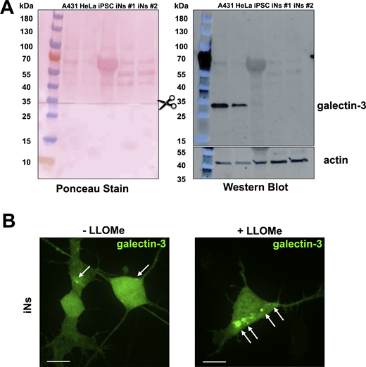 Endogenous expression level of galectin-3 is relatively low in iNs and validation of eGFP-galectin-3 as a sensor of endolysosome damage (associated withFig. 3). (A) Galectin-3 expression levels compared via SDS-PAGE and western blot of lysates from human A431, HeLa, parental iPSCs, and two independently differentiated iNs. The membrane was first probed for endogenous galectin-3, then cut at the indicated region and the lower portion was probed for actin, and finally, both portions stained with Ponceau. Western blot shows significantly lower galectin-3 expression in iPSCs and iNs when compared with A431 and HeLa cells. (B) iNs ectopically expressing eGFP-galectin-3 were treated with or without 0.5 mM LLOMe for 1 h to induce endolysosomal damage. Cells were imaged using spinning disc confocal microscopy. Representative maximum z-projection images from consecutive optical planes spaced 270 nm apart. Arrows highlight eGFP-galectin-3 spots. This experiment demonstrates the utility of eGFP-galectin-3 as a probe for extensive endolysosomal damage in iNs. Images are representative of 48 and 49 cells expressing eGFP-galectin-3 without or with LLOMe treatment from one biological replicate. Scale bar: 10 µm. Source data are available for this figure: SourceData FS3. Refer to the image caption for details.