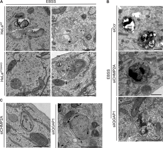 Additional types of profiles in electron micrographs from ultrastructural analyses. (A) HeLaWT and HeLaATG9AKO cells. Note autophagosome and DGC in HeLaWT cells and HDP and fewer DGC in HeLaATG9AKO. (B and C) HeLa cells knocked down for CHMP2A or IQGAP1. siRNA: siSCr control, CHPM2A or IQGAP1. A, autophagosome; DGC, degradative compartments; ER, endoplasmic reticulum; HDP, high density particle; M, mitochondria; N, nucleus; E, endosome; PM, plasma membrane. Scale bar, 500 nm. Source data are available for this figure: SourceData FS4.