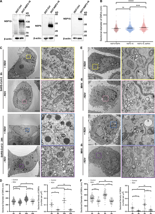 DsRNA rather than other NSPs is critical for determining the DMV size. (A) IB analysis of the NSP12, NSP5, and NSP15 expression in HEK-293T cells stably expressing SARS-CoV-2 NSP3-16, where NSP5-11 and NSP13-16 were polyproteins. (B) Quantification of the size of DMVs is shown as mean ± SEM. n (number of analyzed DMVs) = 111, 339, and 401 for NSP3/4, NSP3-16, NSP3-16+dsRNA, respectively. Student’s two-tailed t test, ***: P < 0.001. ****: P < 0.0001. ns: not significant. (C) TEM analysis of the DMVs induced by SARS-CoV-2 at 6 or 24 hpi with or without RDV treatment. Each boxed area in a low-magnification TEM micrograph (left) is depicted in detail in a high-magnification one (right). Scale bars: 2 μm for low-magnification TEM micrographs, 200 nm for high-magnification TEM micrographs. (D) Quantification of the size of DMVs is shown as mean ± SEM (left). n (number of analyzed DMVs) = 129, 128, 255, and 47 for control 6 hpi, RDV 6 hpi, control 24 hpi, and RDV 24 hpi, respectively. Quantification of DMV density is shown as mean ± SEM (right). n (number of analyzed DMVs) = 10, 9, 10, and 10 for control 6 hpi, RDV 6 hpi, control 24 hpi, and RDV 24 hpi, respectively. Student’s two-tailed t test, **: P < 0.01. ****: P < 0.0001. ns: not significant. (E) TEM analysis of the DMVs induced by MHV-A59 at 4 or 8 hpi with or without RDV treatment. Each boxed area in a low-magnification TEM micrograph (left) is depicted in detail in a high-magnification one (right). Scale bars: 2 μm for low-magnification TEM micrographs, 200 nm for high-magnification TEM micrographs. (F) Quantification of the size of DMVs is shown as mean ± SEM (left). n (number of analyzed DMVs) = 84, 33, 88, and 56 for control 4 hpi, RDV 4 hpi, control 8 hpi, and RDV 8 hpi, respectively. Quantification of DMV density is shown as mean ± SEM (right). n (number of analyzed DMVs) = 22, 19, 43, and 27 for control 4 hpi, RDV 4 hpi, control 8 hpi, and RDV 8 hpi, respectively. Student’s two-tailed t test, **: P < 0.01. ***: P < 0.001. ****: P < 0.0001. ns: not significant. Source data are available for this figure: SourceData F5. Refer to the image caption for details.