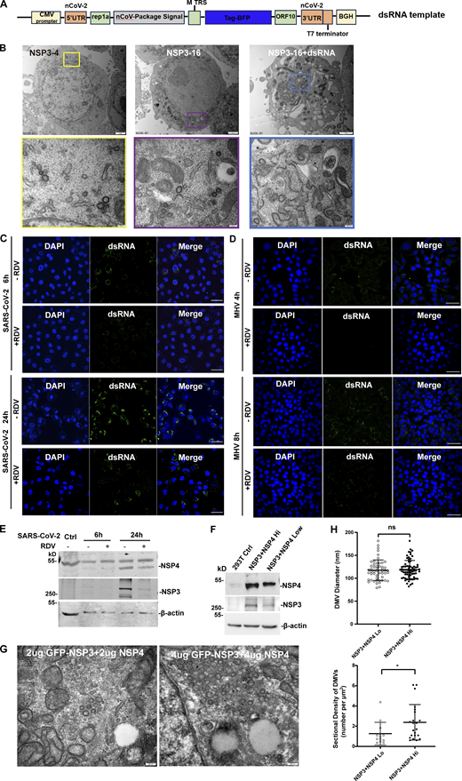 TEM analysis of the DMVs in HEK-293T cells, confocal microscopy analysis of dsRNA signal in the SARS-CoV-2–infected Vero-E6 cells and MHV-A59–infected 17Cl-1 cells, and the expression level of NSP3/4 only affects the density but not the size of DMVs, related toFig. 5. (A) The schematic structure of the SARS-CoV-2 genome template. (B) TEM analysis of the DMVs induced by SARS-CoV-2 NSP3/4 (left), NSP3-16 (middle), and NSP3-16+dsRNA (right) in HEK-293T cells. Each boxed area in a low-magnification TEM micrograph (upper) is depicted in detail in a high-magnification one (bottom). Scale bar, 2 μm for low-magnification TEM micrographs, 200 nm for high-magnification TEM micrographs. (C and D) Confocal microscopy analysis of dsRNA signal in the SARS-CoV-2–infected Vero-E6 cells at 6 or 24 hpi (C) and MHV-A59–infected 17Cl-1 cells at 4 or 8 hpi (D) with or without RDV treatment. Scale bar, 20 μm. (E) IB analysis of the NSP3 and NSP4 expression in Vero-E6 cells in SARS-CoV-2 infected at 6 or 24 hpi with or without RDV treatment. n = 3 independent experiments. (F) IB analysis of the NSP3 and NSP4 expression in low-dose (2 μg) and high-dose (4 μg) NSP3/4 transfection. n = 3 independent experiments. (G) TEM analysis of the DMVs induced by low-dose (2 μg, left) and high-dose (4 μg, right) NSP3/4. Scale bar, 200 nm. (H) Quantification of the size of DMVs is shown as mean ± SEM. n (number of analyzed DMVs) = 52 and 72; quantification of DMV density is shown as mean ± SEM. Student’s two-tailed t test, *: P < 0.05. ns: not significant. Source data are available for this figure: SourceData FS4. Refer to the image caption for details.