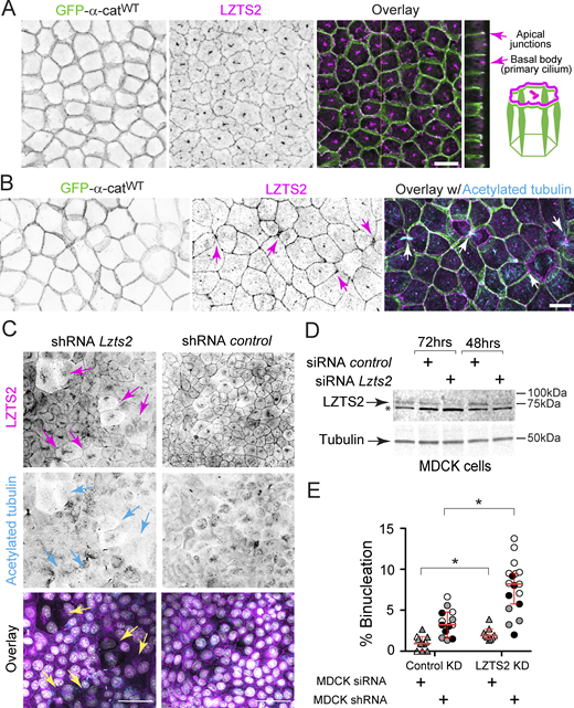 α-cat proximity partner, LZTS2, localizes to apical junctions, base of primary cilia and midbody and is required for successful cell division in MDCK cells. (A) Confocal en face image (maximum z-projection; inverted grayscale) and orthogonal view images of MDCK cells on polycarbonate filters showing LZTS2 localizes to apical junctions and basal body (primary cilium), with schematic illustration. α-cat (green) and LZTS2 (magenta). Scale bar, en face 10 μm; orthogonal scale, 3 μm. (B) Confocal images of MDCK cells on coverslips showing LZTS2 is enriched at midbodies during cell abscission (magenta arrows) and multivertex junctions in mitosis (magenta arrowhead; see also Fig. 8). α-cat (green), LZTS2 (magenta), acetylated tubulin (cyan). Scale bar, 10 μm. (C) Confocal images showing transient knockdown of LZTS2 expression using shRNA in MDCK cells promotes binucleation (colored arrows). LZTS2 (magenta), Acetylated tubulin (cyan). Scale bar, 50 μm. Representative images from two independent experiments (n = 2) are shown. (D) Immunoblots of total cell extracts showing partial knockdown of LZTS2 expression using siRNA (48 or 72 h after transfection). Asterisk (*) denotes non-specific band refractory to knock-down and possibly responsible for strong detection of perinuclear/Golgi structures by immunofluorescence (evident in C and Fig. S3). (E) Percentage of multinucleated MDCK cells upon transient knockdown of LZTS2 expression using either shRNA (three biological replicates) or siRNA (two biological replicates). Two-tailed unpaired t test, *P < 0.05. ***P < 0.001. Graph indicates mean ± SD. Source data are available for this figure: SourceData F5. Refer to the image caption for details.