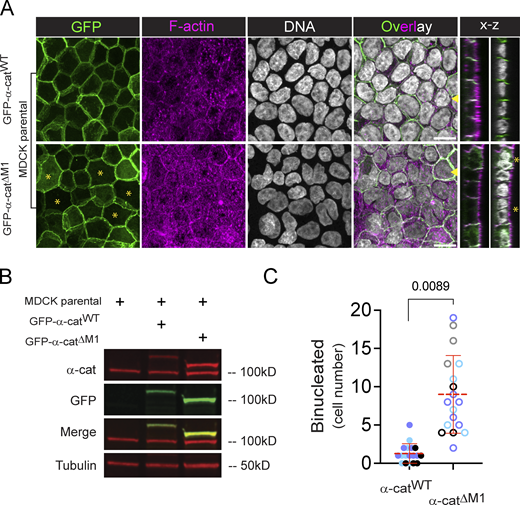 α-cat-ΔM1 is sufficient to induce binucleation in parental MDCK cells. (A) Confocal images of filter-grown parental MDCK cells stably expressing GFP-α-cat WT or GFP-α-catΔM1 mutants. α-cat/GFP (green), F-actin (magenta) and DNA (gray) reveal abundant binucleation associated with α-catΔM1 expression (yellow asterisks). Maximum z-projection is shown; x-z stacks of shown to right, where yellow arrowhead marks position of optical slice). Scale bar 10 μm. Representative images from multiple independent experiments are shown. (B) Immunoblot of GFP-α-cat construct expression in MDCK parental cells with tubulin loading control. (C) Binucleation rate counted manually across 18 fields of view, where distinct symbol colors reflect different biological replicates. Graph indicates mean ± SD. Statistical significance by t test (P = 0.0089). Source data are available for this figure: SourceData FS8. Refer to the image caption for details.
