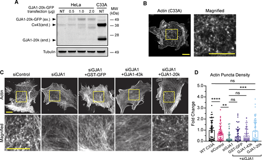 Endogenous GJA1-20k expression results in the formation of actin puncta. (A) Western blot comparison of exogenous (ex.) GJA1-20k-GFP in HeLa cells and endogenous (end.) Cx43 and GJA1-20k in non-transfected (NT) C33A cells. HeLa cells were either NT or transfected with 0.5, 1, or 2 µg of GJA1-20k-GFP (predicted band size for GJA1-20k-GFP = 47 kDa). (B) Representative live-cell confocal imaging of actin, visualized by LifeAct-mCherry, in a wild-type C33A cell; scale bars = 10 µm. (C) Representative live-cell confocal imaging of actin, visualized by LifeAct-mCherry, in C33A cells after treatment with either control siRNA or siRNA-targeting GJA1 alone or with post siRNA knockdown expression of 0.5 µg of either GST-GFP, GJA1-43k-GFP, or GJA1-20k-GFP; scale bars = 10 µm. (D) Quantification of actin puncta density for all C33A transfection cell conditions. Data are presented as mean ± SD (n = 50–65 cells per group from three independent experiments). ns = P > 0.05, *P < 0.05, **P < 0.01, ***P < 0.001, ****P < 0.0001 by one-way ANOVA with multiple comparisons with Bonferroni’s post hoc test. Source data are available for this figure: SourceData F2. Refer to the image caption for details.
