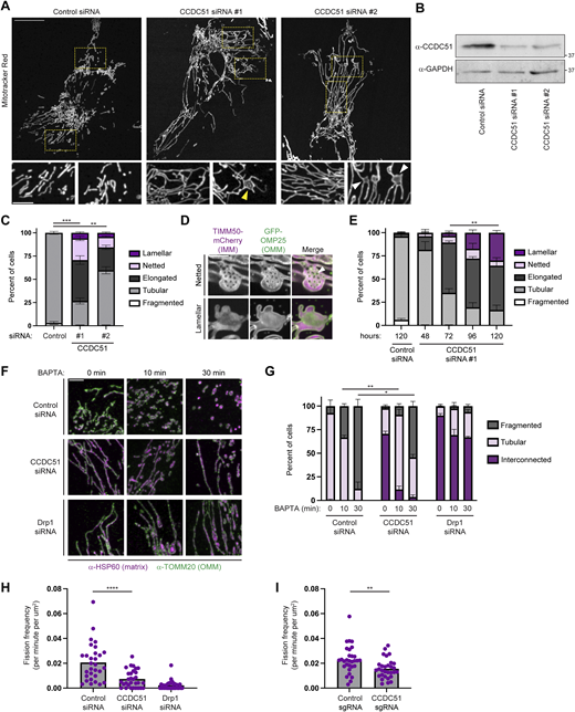 Depletion of CCDC51 reduces the rate of mitochondrial fission. (A) Representative maximum projection confocal images are shown of U2OS cells 72 h after treatment with the indicated siRNAs and stained with MitoTracker Red. Insets at the bottom correspond to the indicated dashed boxes. The yellow arrow marks a netted mitochondrion and white arrows mark lamellar mitochondria. (B) Western blot analysis with the indicated antibodies of lysate from cells treated as in A. (C) A graph of mitochondrial morphology characterization from the indicated siRNA-treated cells as in A and B. Data shown represent 100 cells per condition in each of three independent experiments, and bars indicate SEM. Asterisks (***P < 0.001; **P < 0.01) represent unpaired two-tailed t tests of tubular mitochondrial morphology. (D) Representative single-plane SoRa microscopy images of netted mitochondrial morphology (top) and lamellar mitochondrial morphology (bottom) of CCDC51 siRNA-treated cells expressing TIMM50-mCherry and GFP-OMP25. The arrow marks an example fenestra that spans both the OMM and IMM. (E) As in C at the indicated times after treatment with control siRNA or CCDC51 siRNA #1. Data shown represent 50–100 cells per condition in each of three independent experiments, and bars indicate SEM. Asterisks (**P < 0.01) represent an unpaired two-tailed t test of lamellar mitochondrial morphology. Corresponding representative images and western analysis are shown in Fig. S2, A and B. (F) Representative maximum intensity projection confocal images are shown of cells treated with the indicated siRNA and treated with 10 µM BAPTA-AM for the indicated times. See also Fig. S2 C for corresponding western analysis. (G) A graph of mitochondrial morphology characterization from cells as in F. Data shown represent 50–100 cells per condition in each of three independent experiments, and bars indicate SEM. Asterisks (**P < 0.01; *P < 0.03) represent unpaired two-tailed t tests of fragmented mitochondrial morphology. (H and I) A graph displaying the rate of mitochondrial fission for (H) individual cells treated with the indicated siRNA for 72 h or (I) the indicated CRISPRi cells. Cells were stained with MitoTracker Red and imaged for 5 min by single-plane confocal microscopy. For each cell, fission rates were determined in a 15 × 15-µm region of interest (ROI) of the cell periphery and were normalized to the 2D area of mitochondrial staining within the ROI. Data shown represent a total of 30 cells per condition acquired from two independent experiments. Asterisks (****P < 0.0001; **P < 0.01) represent unpaired two-tailed t tests. Scale bars: (A) 15 µm (5 µm in insets); (D) 5 µm; and (F) 4 µm. Source data are available for this figure: SourceData F2.