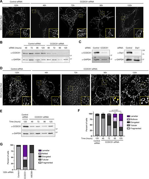 Prolonged CCDC51 depletion leads to mitochondrial hyperfusion that precedes formation of lamellar mitochondria. (A) Single-plane deconvolved images are shown of U2OS cells at the indicated times after treatment with the indicated siRNA oligonucleotides and stained with MitoTracker Red. Insets correspond to dashed boxes. Images correspond to quantification shown in Fig. 2 E. (B) Western blot analysis with the indicated antibodies of lysate from cells treated as in A and Fig. 2 E. (C) Western blot analysis with the indicated antibodies of lysate from cells corresponding to Fig. 2, F and G. (D) Single-plane deconvolved images are shown of HeLa cells at the indicated times after treatment with the indicated siRNA oligonucleotides and stained with MitoTracker Red. Insets correspond to dashed boxes. Yellow arrows mark mitochondrial bulbs and white arrows mark lamellar mitochondria. (E) Western blot analysis with the indicated antibodies of whole-cell lysate from cells treated as in D. (F) A graph is shown of mitochondrial morphology characterization from cells as in D and E. Data shown represents 50–100 cells per condition in each of three independent experiments, and bars indicate SEM. The P value shown represents an unpaired two-tailed t test of lamellar mitochondrial morphology. (G) A graph is shown of mitochondrial morphology characterization of cells treated with the indicated siRNA for 120 h. Data represent an average of results from two independent experimental replicates with at least 75 cells counted per experiment. Scale bars: (A) 15 µm (3 µm in inset); (D) 15 µm (5 µm in inset). Source data are available for this figure: SourceData FS2.