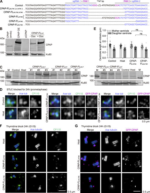 Generation and characterization of stable cell lines expressing WT or mutant GFP-CPAP. (A) Sequencing results of the genomic mutation using gel-purified PCR products. (B) Western blots illustrating that the Flp-In–induced protein expression system has a low level of leaky expression, where CPAP endogenous (endo) is compared with CPAP overexpression (OE). (C) Western blots illustrating the CPAP expression levels in control, host, and different GFP-CPAP-FLWT and GFP-CPAP-FLMUT cells lines without doxycycline induction. (D) Immunofluorescence images taken with Airyscan 2 confocal microscope of centrioles of cells blocked for 24 h in mitosis with S-trityl-L-cysteine (STLC) and stained for the acetylated tubulin (blue), CP110 (green), and GFP-CPAP (magenta). (E) Median ± IQR of centriole length in mitotically blocked cells by STLC, measured as in Fig. 8 F. Number of analyzed mother centrioles (MC) and daughter centrioles (DC): control cells, n = 74 MC, 53 DC; host, n = 71 MC, 44 DC; CPAP-FLWT#3, n = 66 MC, 69 DC, and CPAP-FLMUT#1, n = 50 MC, 40 DC; and nonsignificant (ns) calculated using Kruskal–Wallis ANOVA test. (F and G) U-ExM images of centrioles from host, CPAP-FLWT#4, and CPAP-FLMUT#5 cells blocked in G1/S and stained for acetylated tubulin (blue) combined with CP110 (green) in F and CPAP (magenta) in G. (F) Normal centrioles from host and CPAP-FLWT#4 and incomplete centriole from CPAP-FLMUT#5. (G) Normal centrioles from host and CPAP-FLWT#4 and incomplete centriole from CPAP-FLMUT#5. Scale bar is corrected for ∼4.5 expansion factor. Source data are available for this figure: SourceData FS5. Refer to the image caption for details.