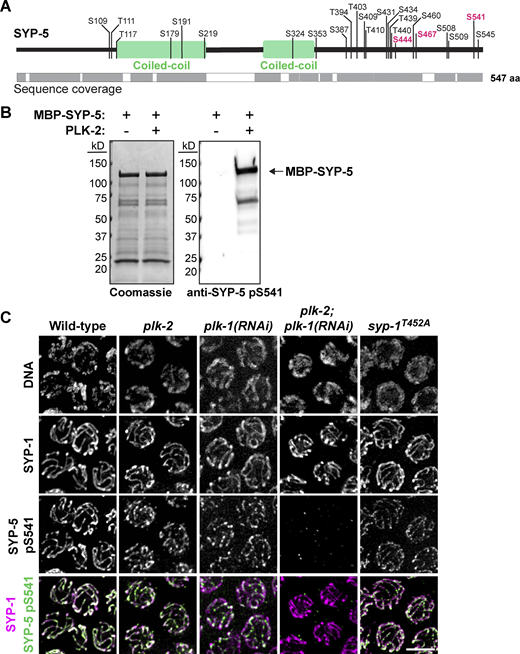 Phosphorylation of SYP-5 S541 requires both PLK-1 and PLK-2, but not the PLK-docking site on SYP-1. (A) Schematic showing in vitro PLK-2 phosphorylation sites on SYP-5, with sequence coverage from mass spectrometry analysis indicated by gray blocks. Conserved residues that conform to the PLK consensus motif are highlighted in magenta. (B) In vitro kinase assays using recombinant 6His-MBP-SYP-5 incubated with or without PLK-2. Coomassie staining of the purified proteins (left) and western blot for SYP-5 pS541 (right) are shown. 6His-MBP-SYP-5 is indicated by an arrow. (C) Immunofluorescence images of pachytene nuclei from wild type, plk-2(tm1395), plk-1(RNAi), plk-2(tm1395); plk-1(RNAi), and syp-1T452A animals, stained for SYP-1 (magenta), and SYP-5 pS541 (green). Scale bar, 5 µm. Source data are available for this figure: SourceData F2. Refer to the image caption for details.