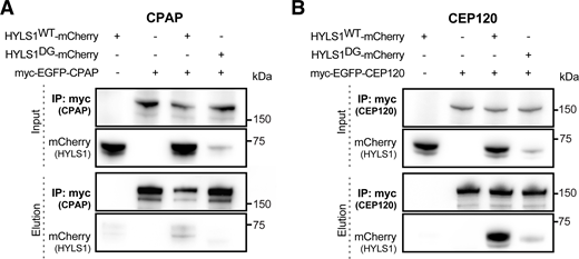 Co-immunoprecipitation analysis of HYLS1 with CPAP and CEP120. (A) Representative co-immunoprecipitation of Myc-EGFP-CPAP in HYLS1−/− DLD1 cells with HYLS1-mCherry (WT or D211G) add-back. Cells were induced with doxycycline for 4 days and Myc-EGFP-CPAP transfected on the second day for 48 h. (B) Representative co-immunoprecipitation of Myc-EGFP-CEP120 in HYLS1−/− DLD1 cells with HYLS1-mCherry (WT or D211G) add-back. Cells were induced with doxycycline for 4 days and Myc-EGFP-CEP120 transfected on the second day for 48 h. Source data are available for this figure: SourceData FS9. Refer to the image caption for details.