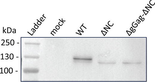 Analysis of virions released by the GFP/RFP cell line–expressing tagged MLV constructs by using western blotting. The Gag-24ST protein was detected using the anti-CA antibody at the expected size (WT: 134 kDa and mutants: 127 kDa). Source data are available for this figure: SourceData FS1.