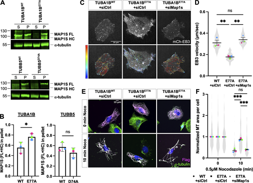 Map1s depletion in cells overexpressing of Flag-TUBA1BE77Ais sufficient to rescue microtubule growth rate and stability. (A) Western blot for MAP1S (top) and tubulin (bottom) in soluble and polymerized tubulin fractions from wild-type cells overexpressing Flag-TUBA1BWT, Flag-TUBA1BE77A, TUBB5WT-Flag, or TUBB5D74A-Flag. Note that the tubulin loading control images in both panels (bottom) are the same as the ones in the supplemental panel S5E, since the two blots shown come from the same experimental repeat. (B) Quantification of the fraction of MAP1S associated with the polymerized tubulin. Mean ± SD, N = 3, Flag-TUBA1BWT versus Flag-TUBA1BE77A: *P = 0.042, two-tailed paired t test. Symbol colors indicate paired measurements. (C) mCherry-EB3 signal (top) and tracks color-coded by mean straight line speed ranging from 0 to 0.4 μm/s (bottom) from movies of wild-type cells overexpressing Flag-TUBA1BWT or Flag-TUBA1BE77A, siCtrl or siMap1s, and mCherry-EB3 (Video 6). Scale bar = 20 μm. (D) Quantification of the average EB3 comet velocity. Mean ± SEM, N = 3 (n = 15 cells per condition), Flag-TUBA1BWT + siCtrl versus Flag-TUBA1BE77A + siCtrl: **P = 0.004, Flag-TUBA1BE77A + siCtrl versus. Flag-TUBA1BE77A + siMap1s: **P = 0.002, one-way RM ANOVA corrected for multiple comparisons. Symbol colors indicate paired average measurements. Violin plot represents the distribution of average EB3 comet velocity for individual cells. (E) Immunofluorescence images of wild-type cells overexpressing Flag-TUBA1BWT or Flag-TUBA1BE77A and siCtrl or siMap1s and treated with 0.5 μM nocodazole for 0 or 10 min, extracted, fixed in methanol, and stained for Flag (magenta), ⍺-tubulin (green), and DAPI (blue). Scale bar = 10 μm. (F) Quantification of the average microtubule-positive area per cell normalized to t = 0. Mean ± SEM, N = 3 (n = 112–194 cells per condition), 10 min Flag-TUBA1BWT + siCtrl versus Flag-TUBA1BE77A + siCtrl: ***P = 0.001, 10 min Flag-TUBA1BE77A + siCtrl versus. Flag-TUBA1BE77A + siMap1s: ***P = 0.001, two-way RM ANOVA corrected for multiple comparisons. Symbol colors indicate paired average measurements. The truncated violin plot represents the distribution of the average microtubule-positive area for individual cells. Source data are available for this figure: SourceData F6. Refer to the image caption for details.