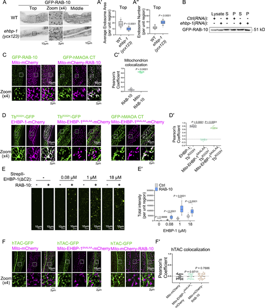 EHBP-1 sequesters exocytic carriers through a mechanism dependent on RAB-10. (A–A″) Confocal images showing the subcellular localization of GFP-RAB-10. Statistical data is shown as box-and-whisker plots with 10th–90th percentile (n = 24 cells from eight animals of each genotype; dots, outliers; boundaries, quartiles; two-tailed Mann–Whitney test). (B) Western blotting showing the results of membrane fractionation for GFP-RAB-10. S: supernatant; P: pellet. (C and C′) Confocal images showing colocalization between RAB-10 and mitochondria. The statistical analysis of colocalization was calculated as the Pearson’s correlation coefficient and is shown as the mean ± SD (n = 18 cells from six animals of each genotype; two-tailed Mann-Whitney test). (D and D′) Confocal images showing colocalization between GFP or mCherry fusion proteins. The statistical analysis of colocalization was calculated as the Pearson’s correlation coefficient and is shown as the mean ± SD (n = 18 cells from six animals of each genotype; one-way ANOVA test with Dunn’s multiple comparison). (E and E′) The images were acquired using a TIRF microscope showing liposomes captured by slides immobilized with StrepII-EHBP-1(ΔC2). Statistical data is shown as box-and-whisker plots with the 10th–90th percentile (n = 24 areas; dots, outliers; boundaries, quartiles; two-way ANOVA with Bonferroni post-test). (F and F′) Confocal images showing colocalization between hTAC-GFP and Mito-mCherry or Mito-EHBP-16AALAA-mCherry or Mito-mCherry-RAB-10. The statistical analysis of colocalization was calculated as the Pearson’s correlation coefficient and is shown as the mean ± SD (n = 18 cells from six animals of each genotype; one-way ANOVA test with Dunn’s multiple comparison). Source data are available for this figure: SourceData FS4. Refer to the image caption for details.