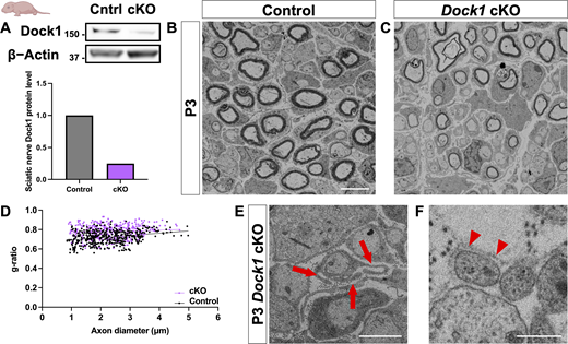 SC-specific Dock1 MUTs present with multiple defects in peripheral nerves. (A) Western blot (kD) showing sciatic nerve Dock1 and β-actin protein levels from control and Dock1 cKO animals and quantification of normalized protein levels. (B and C) TEM micrographs of sciatic nerves from DhhCre+;Dock1+/+ control and littermate DhhCre+;Dock1fl/fl cKO mice at P3. (D) Quantification of the g-ratio as it relates to axon caliber, n = 6 mice, 4 images per nerve (WT); 6 mice, 4 images per nerve (cKO). (E)Dock1 cKO MUT SCs display abnormal cytoplasmic protrusions that extend in multiple directions (red arrows). (F) Trails of basal lamina found in Dock1 cKO MUTs are observed in regions devoid of SC cytoplasm (red arrowheads). (B and C) Scale bar = 4 µm. (E and F) Scale bar = 1 µm. Source data are available for this figure: SourceData F3. Refer to the image caption for details.