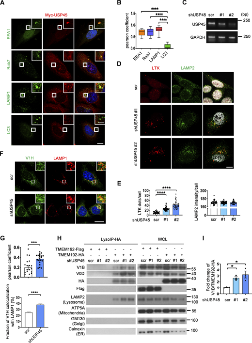 Depletion of USP45 causes enrichment of V-ATPase at the lysosome. (A) Immunofluorescent analysis of the colocalization of transiently transfected Myc-USP45 and endogenous vesicle markers (EEA1, Rab7, LAMP1, and LC3) in HeLa cells using the indicated antibodies. Scale bar, 10 μm (original) and 4 μm (zoom-in). (B) Quantification of colocalization of Myc-USP45 and markers in A. Data are shown as mean ± SEM in n = 3, ≥15 cells from three independent experiments. (C) RT-PCR analysis of USP45 expression in control and USP45 knockdown HeLa cells. (D) Immunofluorescent analysis of LysoTracker (LTK) and lysosome (LAMP2) in USP45 knockdown cells. Scale bar, 10 μm. (E) Quantification of LTK dot number and LAMP2 intensity respectively in D. Data shown as mean ± SEM in n = 3, ≥40 cells. (F) Immunofluorescent analysis of colocalization of V-ATPase subunit (V1H) and lysosome (LAMP1). Scale bar, 20 μm. (G) Quantification of colocalization of V1H and LAMP1 in F. ± SEM in n = 3, ≥20 cells. (H) Lysosomal immunoprecipitation (LysoIP) analysis of V-ATPase subunits (V1Band V0D) in enriched lysosome lysate by precipitating TMEM192-HA (TMEM192-Flag as negative control) in control and USP45 knockdown HEK293T cells. V-ATPase subunits (V1B, V0D) and organelle markers (lysosome, LAMP2; mitochondria, ATP5A; Golgi, GM130; and ER, Calnexin) were detected by antibodies. (I) Quantification of V1B normalized to HA. Data are shown as mean ± SEM from three independent experiments. Significance was determined using one-way ANOVA and Tukey‘s (B) or Dunnett’s (E and I) multiple comparisons test, and Student’s t test (G); *P < 0.05; ***P < 0.001; ****P < 0.0001. Data shown as mean Source data are available for this figure: SourceData FS2. Refer to the image caption for details.