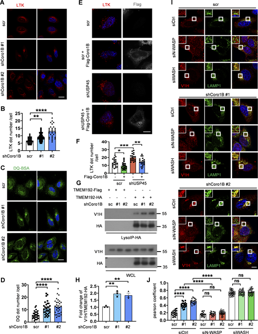 CORO1B knockdown promotes lysosomal function and V-ATPase translocation to lysosome in an N-WASP-dependent manner. (A) Immunofluorescent analysis of LysoTracker (LTK) in control and CORO1B knockdown HeLa cell. Scale bar, 10 μm. (B) Quantification of LTK dot number in A. Data are shown as mean ± SEM in n = 3, ≥30 cells. (C) Confocal microscopic analysis of DQ-BSA in control and CORO1B knockdown cells. Scale bar, 10 μm. (D) Quantification of DQ-BSA number in C. Data are shown as mean ± SEM in n = 3 , ≥30 cells. (E) Confocal microscopic analysis of LTK signals in control and USP45 knockdown cells with or without Flag-Coro1B overexpression. Scale bar, 10 μm. (F) Quantification of LTK dot number in E. Data shown as mean ± SEM in n = 3, ≥20 cells. (G) Lysosomal immunoprecipitation (LysoIP) analysis of V-ATPase subunit (V1H) in enriched lysosome lysate of control and CORO1B knockdown HEK293T cells. TMEM192-Flag was emerged as negative control. (H) Quantification of V1H normalized to HA in G. Data shown as mean ± SEM in three of independent experiments. (I) Immunofluorescent analysis of the colocalization of the V-ATPase subunit (V1H) and lysosome marker (LAMP1) in control and Coro1B-depleted HeLa cells with knockdown of control or WASP family proteins (N-WASP, WASH) by the indicated siRNAs. (J) Quantification of colocalization of V1H and LAMP1 in I. Data are shown as mean ± SEM in n = 3, ≥20 cells. Significance was determined using one-way ANOVA and Dunnett’s (B, D, and H) or Tukey‘s (F and J) multiple comparisons test; **P < 0.01; ***P < 0.001; ****P < 0.0001. Source data are available for this figure: SourceData FS5.