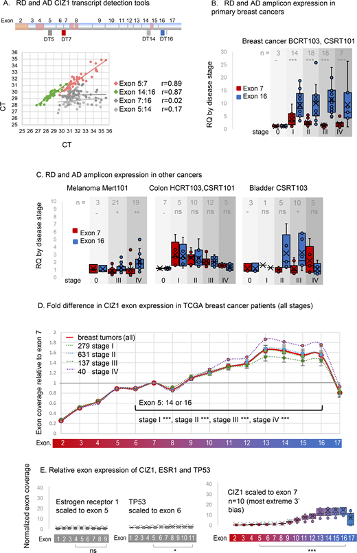 Elevated CIZ1 anchor domain expression in primary cancers. (A) Exon structure of CIZ1 based on human reference sequence NM_012127.2 showing all 16 translated exons (2–17), and those subject to alternative splicing (pink) (Coverley et al., 2005; Dahmcke et al., 2008; Higgins et al., 2012; Rahman et al., 2007; Sofi et al., 2022; Swarts et al., 2018). Alternative untranslated exons 1’s are not shown. The location of amplicons detected by quantitative RT-PCR detection tools (four Taqman primer/probe sets; DT5 and DT7 which detect the 5′ end of CIZ1 transcripts, and DT14 and DT16 which detect the 3′ end) are indicated. Below, the dot plot shows the comparison of outputs with the indicated pairs applied to 46 human tissue-derived cDNAs. Pearson’s correlation coefficients show strong agreement between exons 5 and 7, and between 14 and 16, but poor agreement between exons 7 and 16, or 5 and 14, indicating that the 5′ and -3′ ends of CIZ1 are typically imbalanced at the transcript level. (B) Relative quantification (RQ) of CIZ1 exon 7 (red) and CIZ1 exon 16 (blue) in primary human breast tissue-derived cDNAs in arrays BCRT103 and CSRT101 (n = 60, all female). Box and whisker plots show results aggregated by clinical stage (0–IV), calibrated to the average of the stage 0 samples for each amplicon where 0 represents histologically normal tissue. Significance indicators show comparisons between amplicons by t test, where ns is not significant, *P < 0.05, **P < 0.01, ***P < 0.001. Individual sample values are given in Data S2. (C) As in B for human tissue-derived cDNAs in arrays MERT101 (melanoma, n = 43), HCRT103, CSRT101 (colon, n = 39), and CSRT103 (bladder, n = 24). (D) CIZ1 exon expression in TCGA breast cancer samples, separated by clinical stage and normalized to individual exon 7 expression. At all stages, 5′ and 3′ expression is significantly different, with 3′ elevation from around exon 10. Comparison of transcript levels in exon 5 to 14 or 16 (arrows) is by Mann–Whitney U test. Error bars show SEM. n = 1,087, 99% female. (E) Control analysis showing TPMs in a subset of 10 stage 2 TCGA breast cancer patients that exhibit the most marked 3′ end bias for CIZ1, mapped to CIZ1 exons, normalized to exon 7. Left, TPMs from the same patients for estrogen receptor alpha (ERα/ESR1) normalized to its exon 5, and TP53 normalized to its exon 6, showing relative exon coverage and lack of 3′ over-representation. Refer to the image caption for details.