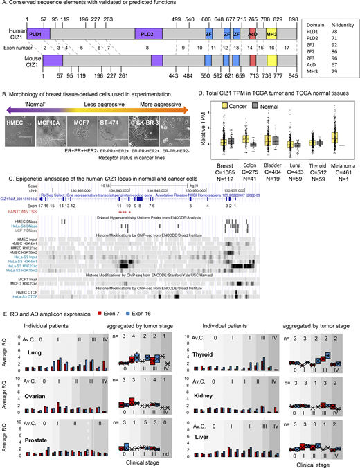 (Related toFig. 1andFig. 2). CIZ1 domains, transcript levels, and domain expression in common solid tumors. (A) Protein domain map aligning human (NP_001124488.1) and mouse (NP_082688.1) CIZ1. Numbers correspond to amino acids encoded at exon boundaries. The domains highlighted are: Prion-like domains 1 and 2 (PLD1 and PLD2, purple) at positions 1–78 and 360–451, respectively (human), and positions 1–67 and 361–399, respectively (mouse),10 three zinc fingers (ZnF_C2H2 SM00355, ZF_C2H2 sd00020, and ZF_C2H2 sd00020, blue) at positions 593–617, 656–676, and 687–709, respectively (human), and 537–561, 600–620, and 631–653, respectively (mouse), an acidic domain (red) containing a concentrated area of aspartates and glutamates at position 741–761 (human) and 689–709 (mouse), and a matrin-3 homology domain (ZnF_U1 smart0045, yellow) at position 796–831 (human) and 746–770 (mouse). Box shows % identity at the amino acid level across these domains. Human and mouse CIZ1 are 65% identical at the protein level, with identity concentrated in the conserved domains (up to 96%). (B) Bright-field images of breast-derived cell types ordered based on phenotype, with corresponding hormone and growth factor receptor status. The bar is 100 μm. (C)CIZ1 locus in Homo sapiens with corresponding exon numbers. Potential CIZ1 alternative transcription start sites (TSSs) in exons 10 and 11 predicted in the FANTOM5 project (Lizio et al., 2015) are indicated (red stars). The coding sequence would be expected to begin at a methionine in exon 11. The chromatin landscape in human mammary epithelial cells (HMEC), a cervical cancer cell line (HeLa) and a breast cancer cell line (MCF7) is shown below. Diagram generated using UCSC genome browser (Cunningham et al., 2022). (D) Total CIZ1 TPM derived from the indicated number of cancer (C) and normal (N) tissues in TCGA compared using GEPIA for the indicated disease types. No significant difference is detected (where log2FC was >1, and P value <0.05) when comparing all amalgamated transcripts that map to the CIZ1 gene (unresolved by exon). (E) Relative expression of exons 7 (red) and 16 (blue), normalized to the average of three unmatched control samples for each of six common solid tumor types in multi-tissue cDNA array CSRT101. Individual patient data plus the average of the controls calibrated to 1 (Av.C, left) and data aggregated by disease stage (0–IV, right) are shown. 0 represents histologically normal tissue. Individual sample information for all arrays is given in Data S2. Refer to the image caption for details.