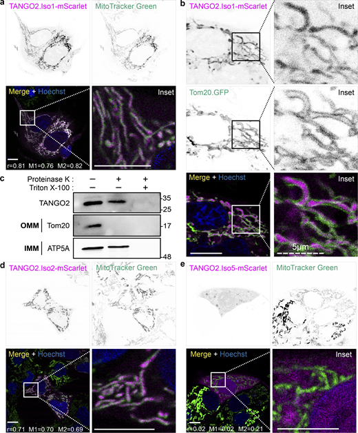 Localization of TANGO2 isoforms 1, 2, and 5. (a) HepG2 cells expressing TANGO2.Iso1-mScarlet (magenta) were incubated with Hoechst-33342 (blue) to detect DNA and MitoTracker Green to visualize the mitochondria. Pearson’s correlation (r) and Mander’s overlap (M1 and M2) coefficients were calculated with the coloc2 plugin in ImageJ software. (b) Cells cotransfected with TANGO2.Iso1-mScarlet (magenta) and Tom20.GFP (green) were incubated with Hoechst-33342 (blue) to detect DNA. (c) HepG2 cells were processed to obtain mitochondria-enriched fractions. The mitochondrial fractions were treated (+) with 50 µg/ml proteinase K for outer membrane protein cleavage and 1% Triton X-100 for total membrane disruption. Samples were resolved by SDS-PAGE and incubated with the antibodies Tom20, sited in the outer mitochondrial membrane, and ATP5A, sited in the inner mitochondrial membrane, and TANGO2. OMM, outer mitochondrial membrane; IMM, inner mitochondrial membrane. (d and e) HepG2 cells expressing TANGO2.Iso2-mScarlet (d) or TANGO2.Iso5-mScarlet (e) were incubated with MitoTracker Green to detect the mitochondria and Hoechst-33342 (blue) to label DNA. Pearson’s correlation (r) and Mander’s overlap (M1 and M2) coefficients were calculated with the coloc2 plugin in ImageJ software. Squares indicate the magnification area (inset). Scale bars = 10 µm. The white color indicates colocalization between magenta and green channels. Images are representative of three independent experiments. Source data are available for this figure: SourceData F1.