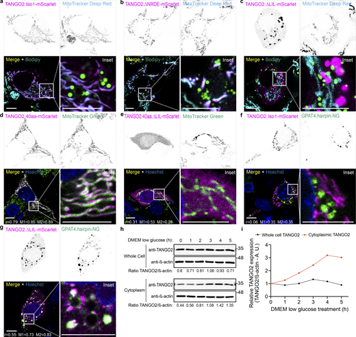 TANGO2 wild-type and mutant location. (a–c) HepG2 cells transfected with TANGO2.Iso1-mScarlet (a), or the mutants TANGO2.∆NRDE-mScarlet (b) and TANGO2.∆LIL-mScarlet (c) were incubated with the LD marker Bodipy Green and the mitochondrial marker MitoTracker Deep Red (cyan). (d and e) HepG2 cells expressing the mutant TANGO2.40aa-mScarlet (d) or TANGO2.40aa.∆LIL-mScarlet (e) were incubated with MitoTracker Green to detect the mitochondria and Hoechst-33342 (blue) to visualize DNA. (f and g) HepG2 cells expressing TANGO2.Iso1-mScarlet (f) or TANGO2.∆LIL-mScarlet (g) were co-expressed with the LD marker construct GPAT4.hairpin-NG (green) and incubated with Hoechst-33342 (blue) to visualize DNA. Pearson’s correlation (r) and Mander’s overlap (M1 and M2) coefficients were calculated with the coloc2 plugin in ImageJ software. Squares indicate the magnification area (inset). Scale bars = 10 µm. Images are representative of three independent experiments. (h) HepG2 cells were incubated in a low-glucose medium for different periods (hour) and mechanically lysed, and the cytoplasmic and whole-cell fractions were analyzed by western blot. β-Actin was used as a loading control. (i) Graph shows the relative expression of the TANGO2/β-actin ratio in the cytoplasmic and whole-cell fractions. Source data are available for this figure: SourceData F2.