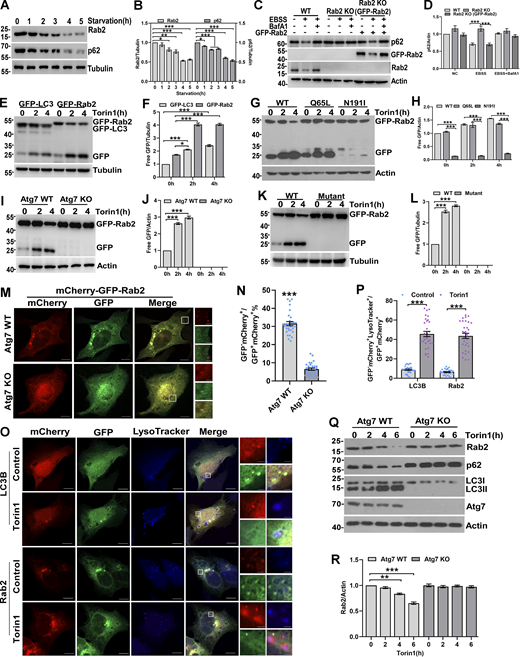 Rab2 is degraded via autophagy pathway. (A and B) U2OS cells were starved in EBSS medium for (0, 1, 2, 3, 4, or 5 h), and the levels of endogenous Rab2 and p62 were measured by western blot (A) and quantified in B. Data are shown as means ± SEM and analyzed with one-way ANOVA. *P < 0.05, **P < 0.01, ***P < 0.001. (C and D) Rab2 wild type (WT) cells, Rab2 knockout (KO) U2OS cells, and Rab2 KO U2OS cells that transiently expressing 1 µg GFP-Rab2, cells were treated with EBSS or EBSS and Bafilomycin A1 for 2 h. Quantification of cleavage GFP is shown in D. Data are shown as means ± SEM and analyzed with one-way ANOVA. ***P < 0.001. (E and F) HEK293T cells transiently expressing GFP-Rab2 or GFP-LC3 were treated with Torin1 for 0, 2, or 4 h. Quantification of cleavage GFP is shown in F. Data are shown as means ± SEM and analyzed with one-way ANOVA. *P < 0.05, ***P < 0.001. (G and H) HEK293T cells transiently expressing GFP-Rab2 WT, GFP-Rab2 Q65L, or GFP-Rab2 N119I were treated with Torin1 for 0, 2, or 4 h. Quantification of cleavage GFP is shown in H. Data are shown as means ± SEM and analyzed with one-way ANOVA. ***P < 0.001. (I and J) Atg7 WT or Atg7 KO HEK293 cells transiently expressing GFP-Rab2 were treated by Torin1 for 0, 2, or 4 h. Quantification of cleavage GFP is shown in J. Data are shown as means ± SEM and analyzed with one-way ANOVA. ***P < 0.001. (K and L) HEK293T cells transiently expressing GFP-Rab2 WT, GFP-Rab2 mutant (Cys211, 212Ser) were treated with Torin1 for 0, 2, or 4 h. Quantification of cleavage GFP is shown in L (n = 3 experimental replicates). Data are shown as means ± SEM and analyzed with one-way ANOVA. ***P < 0.001. (M and N) Atg7 WT or Atg7 KO U2OS cells transiently expressing mCherry-GFP-Rab2 were treated with Torin1 for 2 h and were analyzed by confocal microscopy for mCherry+GFP− puncta. mCherry+GFP− puncta were quantified in N (n = 30 cells per group). Scale bars, 10 μm. The scale bars in the magnification boxes are 2 µm. Data are shown as means ± SEM, and analyzed with Student’s t test (two-tailed, unpaired). ***P < 0.001. (O and P) U2OS cells transiently expressing mCherry-GFP-Rab2 or mCherry-GFP-LC3B, cells were treated with Torin1 for 2 h, staining with LysoTracker Blue DND-22, analyzed by confocal microscopy for mCherry+GFP−LysoTracker+ puncta and quantified in P (n = 30 cells per group). Scale bars, 10 μm. The scale bars in the magnification boxes are 2 µm. Data are shown as means ± SEM and analyzed with Student’s t test (two-tailed, unpaired). ***P < 0.001. (Q and R) Atg7 WT or Atg7 KO HEK293 cells were treated with Torin1 for 0, 2, 4, 6 h and the levels of endogenous Rab2, p62, LC3 and Atg7 were detected by western blot and quantified in R. Data are shown as means ± SEM and analyzed with one-way ANOVA. ***P < 0.001. Molecular weight measurements are in kD. Source data are available for this figure: SourceData F1.