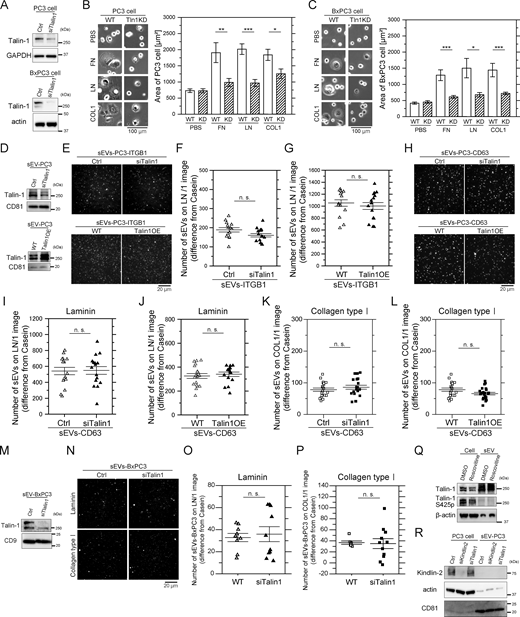 Talin-1 in sEVs does not regulate the binding affinity of integrins for laminin. (A) Western blot analysis of PC3 and BxPC3 cells after talin-1 KD by siRNA. (B and C) Cell spreading assay of WT and talin-1 (Tln1) KD PC3 cells (B) and BxPC3 cells (C) on glass coated with ECM components: fibronectin (FN), laminin (LN), or collagen typeⅠ (COL1). Cells were observed after 2 h of incubation, and cell areas were quantified (n = 35 cells). (D) Western blot analysis of PC3 cell–derived sEVs after talin-1 KD by siRNA or overexpression of talin-1. (E–G) The fluorescence images (E) and the numbers of PC3-sEVs attached to glass coated with laminin before and after (F) talin-1 KD or (G) overexpression of talin-1 (n = 14 images). Halo7-integrin β1 in sEVs was labeled with SF650T. (H–J) The fluorescence images (H) and the numbers of CD63-labeled sEVs attached to glass coated with laminin before and after (I) talin-1 KD and (J) overexpression of talin-1 (n = 16 images). (K and L) The numbers of EV–CD63Halo7-SF650T particles attached to glass coated with collagen type I before and after (K) talin-1 KD or (L) overexpression of talin-1 (n = 21 images). (M) Western blot analysis of BxPC3 cell–derived sEVs after talin-1 KD by siRNA. (N–P) Fluorescence images (N) and the numbers of sEVs-BxPC3 bound to laminin (O) or collagen type I (P) on glass before and after talin-1 KD (n = 7 images). The membranes of sEVs were stained with Exosparkler DeepRed. (Q) Western blot analysis of the phosphorylation of Ser425 on talin-1 in PC3 cells and sEVs. Roscovitine: an inhibitor of CDK5 that phosphorylates Ser425 of talin-1. (R) Western blot analysis of kindlin-2 in PC3 cells and PC3-derived sEVs before and after kindlin-2 KD and talin-1 KD. Data are presented as the mean ± SE. n.s., nonsignificant difference; *P < 0.05; **P < 0.01; ***P < 0.001 according to Welch’s t test (two-sided). Source data are available for this figure: SourceData F7. Refer to the image caption for details.