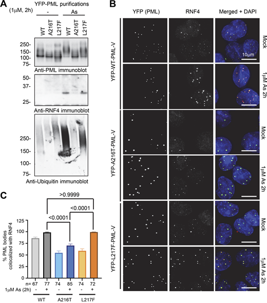 RNF4 is recruited to WT and L217F-PML bodies, but not the A216T variant. (A) Anti-PML, RNF4, and ubiquitin immunoblots from purified PML bodies containing YFP-PML-V WT, A216T, and L217F. (B) Representative images assessing colocalization of RNF4 with YFP-PML-V WT, A216T, and L217F after 1 μM arsenic treatment for 2 h studied by fluorescence microscopy. Merge shows DAPI (blue), YFP (green), and RNF4 (red). (C) Quantitation summary of the colocalization data described in B. Columns are averages with SEM error bars. Colocalization was defined as any RNF4 signal above background within a PML body. Statistical significance was assessed by comparing the arsenic-treated conditions among the three PML types using Dunn’s multiple comparisons tests after Kruskal–Wallis ANOVA. The number of cells counted (n) is indicated in the chart. Source data are available for this figure: SourceData F4.