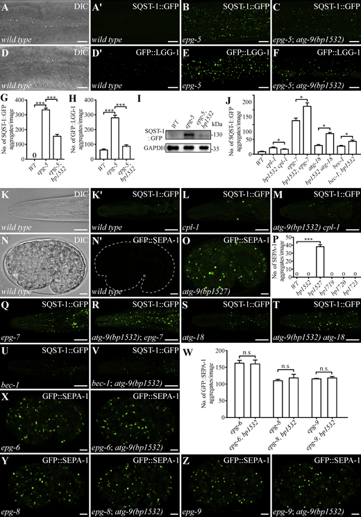 The genetic interaction of atg-9(bp1532) with autophagy mutants. (A–C) In the hypodermis of wild-type animals at the L4 larval stage, SQST-1::GFP is weakly expressed and diffusely localized (A′). A large number of SQST-1::GFP aggregates accumulate in epg-5 mutants (B), which are largely absent in epg-5; atg-9(bp1532) double mutants (C). The C. elegans strains used in this experiment carry a single-copy SQST-1::GFP transgene (bpIs443). Panel A shows the DIC image of the animal in A′. (D–F) In the hypodermis of wild-type L4 larvae, GFP::LGG-1 shows weak accumulation (D′). Numerous GFP::LGG-1 puncta accumulate in epg-5 mutants (E), and this accumulation is largely suppressed in epg-5; atg-9(bp1532) double mutants (F). The C. elegans strains used in this experiment carry a single-copy GFP::LGG-1 transgene (qxIs13). Panel D shows the DIC image of the animal in D′. (G and H) Quantification of the number of SQST-1::GFP aggregates (G) and GFP::LGG-1 puncta (H) per confocal plan in the indicated strains shown (n = 3 animals for each genotype). Data are shown as mean ± SEM; ***, P < 0.001. For comparison, the middle body region of animals at the same developmental stage was analyzed. (I) Immunoblot showing the levels of SQST-1::GFP in extracts from wild-type animals, epg-5 mutants, and epg-5; atg-9(bp1532) double mutants. (J) Quantification of the number of SQST-1::GFP aggregates in the indicated genotypes shown in K–M and Q–V (n = 3 animals for each strain). Data are shown as mean ± SEM; *, P < 0.05. (K–M) Visualization of SQST-1::GFP aggregates in the head region of animals with the indicated genotypes. In the head of wild-type L4 larvae, SQST-1::GFP is weakly expressed and diffusely localized (K′). SQST-1::GFP aggregates accumulate in cpl-1 mutants (L), and the accumulation is suppressed in atg-9(bp1532) cpl-1 double mutants (M). The C. elegans strains used in this experiment carry bpIs151(Psqst-1::sqst-1::GFP+unc-76). Panel K shows the DIC image of the animal in K′. (N and O) No GFP::SEPA-1 aggregates are detected in wild-type embryos at the comma stage. A large number of SQST-1::GFP aggregates accumulate in atg-9(bp1527) null mutants (O). The dashed contour outlines the embryo in N′. Panel N shows the DIC image of the animal in N′. (P) Quantification of the number of GFP::SEPA-1 aggregates in embryos of the indicated strains (n = 3 embryos for each genotype). Data are shown as mean ± SEM; ***, P < 0.001. (Q–V) The number of SQST-1::GFP aggregates in the head region of animals with various genetic backgrounds. SQST-1::GFP aggregates accumulate in epg-7 mutants (Q), atg-18 hypomorphic mutants (S), and bec-1 hypomorphic mutants (U). The number of aggregates is further enhanced in atg-9(bp1532); epg-7 double mutants (R). atg-9(bp1532)atg-18 double mutants (T) and bec-1; atg-9(bp1532) double mutants (V). The C. elegans strains used in this experiment carry bpIs151(Psqst-1::sqst-1::GFP+unc-76). (W–Z) A large number of GFP::SEPA-1 aggregates accumulate in epg-6 null mutant embryos (X), epg-8 null mutant embryos (Y) and epg-9 null mutant embryos (Z) at the comma stage, and this accumulation is not suppressed by atg-9(bp1532). Panel W shows quantification of the number of GFP::SEPA-1 aggregates in embryos of the indicated strains in X–Z (n = 3 embryos for each genotype). Data are shown as mean ± SEM; n.s., no significant difference. Scale bars: 10 μm for A–F; 20 μm for K–M and Q–V; 5 μm for N and O and X–Z. Source data are available for this figure: SourceData FS1.