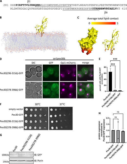 All-atom MD simulations to characterize DysF domain and its membrane interactions. (A) Amino acid sequence of the DysF domain, with residues involved in membrane anchoring underlined, and β1 and β6 strands depicted by bolded text. (B) Snapshot from a simulation of the DysF domain with a 70:30 DOPC:DOPA bilayer. The tails of DOPC and DOPA are shown in grey and blue, respectively. (C) Surface and cartoon representation of the DysF domain. Each residue is colored based on its average number of lipid contacts, with a contact defined as a lipid within 4.5 Å of the residue. (D) WF images of sei1pex30Δ cells endogenously expressing Opi1-mCherry and GFP-tagged Pex30 (296–315Δ) or Pex30 (378–398Δ) plasmids grown to logarithmic phase. Bar = 4 μm. (E) Quantification of cells shown in D showing percent cells with Pex30-GFP accumulation in the indicated strains. Bars show mean from three independent experiments and SEM. 100 cells per genotype from each replicate were analyzed and compared using one-way ANOVA and Dunnett’s multiple comparison test (***P < 0.001). (F) 10-fold serial dilutions of sei1pex30Δ cells expressing Pex30-GFP truncation plasmids were spotted on synthetic media without leucine. Cells were incubated for 2 days at 30°C and 37°C. (G) Western blot analysis of cell lysates from sei1pex30Δ cells expressing Pex30-GFP and DysF truncation plasmids in D. Anti-GFP monoclonal antibody was used to detect Pex30 protein levels, and anti-Porin1 monoclonal antibody was used to detect porin levels as a control. (H) Quantification of protein levels from G. Bars show the mean from two replicates and SEM. One-way ANOVA and Dunnett’s multiple comparison test were used to compare protein levels. Source data are available for this figure: SourceData F5. WF, widefield images. Refer to the image caption for details.