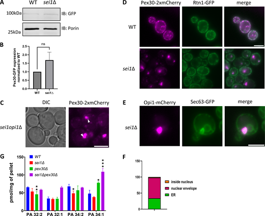 Data associated withFig. 1. (A) Western blot analysis of cell lysates from WT and sei1Δ cells endogenously expressing Pex30-GFP. Anti-GFP monoclonal antibody was used to detect Pex30 protein levels, and anti-Porin1 monoclonal antibody was used to detect porin levels as a control. (B) Quantification of protein levels from A. Bars show the mean from three replicates and SEM. One-way ANOVA and Dunnett’s multiple comparison test were used to compare protein levels. (C) WF images of sei1opi1Δ cells endogenously expressing Pex30-2xmCherry in logarithmic phase. White arrowheads show Pex30 accumulation. Bar = 4 μm. (D) WF images of WT and sei1Δ cells endogenously expressing Pex30-2xmCherry and Rtn1-GFP in logarithmic phase. Bar = 4 μm. (E) WF image of sei1Δ cells endogenously expressing Opi1-mCherry and Sec63-GFP on a plasmid as an ER marker in logarithmic phase. Bar = 4 μm. (F) Quantification of the localization of Opi1-mCherry puncta from E. (G) Phospholipid measurements of indicated strains (n = 3) by LC-HRMS. Distribution of total amounts of annotated PA species (*P < 0.05, **P < 0.01, and ***P < 0.001). Source data are available for this figure: SourceData FS1.. WF, widefield images; LC-HRMS, liquid-chromatography high-resolution mass spectrometry Refer to the image caption for details.