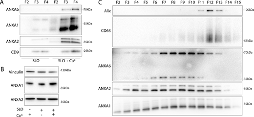Annexins within EVs are shifted in apparent molecular weight. (A) Immunoblots of gradient fractions show enrichment of indicated EV markers after 200 ng/ml SLO treatment, with or without 1 mM Ca2+ in the media. F2, F3, and F4 refer to buoyant fractions of a sucrose step gradient of the conditioned medium 100k × g pellet fraction. (B) Immunoblot analysis of cell lysates after treatment with indicated combinations of 1 mM Ca2+ and 200 ng/ml SLO is shown. (C) Immunoblots show separation of indicated EV markers after 200 ng/ml SLO treatment. F2–F15 refer to fractions #2–15 of an iodixanol gradient of the conditioned medium 100k × g pellet fraction, moving from low to high density. Source data are available for this figure: SourceData F3. Refer to the image caption for details.
