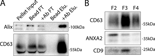Annexin-containing EVs are distinct from exosomes. (A) Immunoblots show enrichment of exosome proteins from the conditioned medium 100k × g pellet (pellet input) after immunoprecipitation with protein G beads when anti-CD63 antibody (Ab) is added to the binding reaction (FT—binding reaction flow through; Elu—binding reaction elution). (B) Immunoblots show the distribution of EV markers across a sucrose step gradient of the conditioned medium 100k × g pellet fraction. Samples were taken from low density (F2-Fraction #2) to high density (F4-Fraction #4). Source data are available for this figure: SourceData FS1. Refer to the image caption for details.
