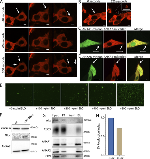 Annexin-containing EVs are shed from the repair scab after plasma membrane damage. (A) Confocal micrographs of ANXA2-mScarlet recruitment in three laser ablation experiments are shown. Image times are relative to the first image taken after ablation. White arrows in the top panes indicate the sites of ablation. Arrows in the bottom panes indicate EVs. Scale bars: 5 μm. (B) Representative confocal micrographs of ANXA2-mScarlet shedding are shown. Image times are relative to the first image taken after ablation. White arrows in panel indicate the site of ablation. Scale bars: 5 μm. (C) Representative confocal micrographs of ANXA2-mScarlet and ANXA1-mNeonGreen–expressing cells after laser ablation. Arrows indicate the ablation site. Scale bars: 10 μm. (D) Representative confocal micrographs of ANXA2-mScarlet and ANXA6-mNeonGreen–expressing cells after laser ablation. Arrows indicate the ablation site. Scale bars: 10 μm. (E) Representative widefield micrographs of cells stained with 1 μM Sytox Green after a treatment period with the indicated SLO concentration and recovery period. Scale bars: 150 μm. (F) Immunoblots show expression of annexin A2-Nluc (A2-Nluc) using a low expression promoter. (G) Immunoblots show enrichment of EV markers after capture with immobilized annexin A5 from the conditioned medium 100k × g pellet fraction (FT—flow through; Elu—elution). (H) EV production index from ANXA2-Nluc cells expressing mCherry-VPS4a (dominant mutant) under control of a doxycycline-inducible promoter. Cells were pretreated with 200 ng/ml doxycycline (Dox) or DMSO for 6 h, followed by treatment with 200 ng/ml SLO. Error bars indicate three experimental replicates. Source data are available for this figure: SourceData FS2. Refer to the image caption for details.