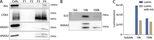 Annexins within EVs are shifted in apparent molecular weight. (A) Immunoblots show enrichment of indicated EV markers relative to cell lysate after treatment of C2C12 myotubes with 200 ng/ml SLO. F1, F2, F3, and F4 refer to buoyant fractions of a sucrose step gradient of the conditioned medium 100k × g pellet fraction, moving from low to high density. (B and C) (B) Immunoblot and (C) luminescence analysis of the 10k × g pellet fraction (10k), the 100k × g pellet fraction (100k), and the remaining soluble supernatant (Sol.) after serial centrifugation of conditioned media from ANXA2-Nluc cells treated with 200 ng/ml SLO. For each fraction, Nluc luminescence (lumin.) was measured with or without membrane-impermeable Nluc inhibitor (Inh.). Source data are available for this figure: SourceData FS3.