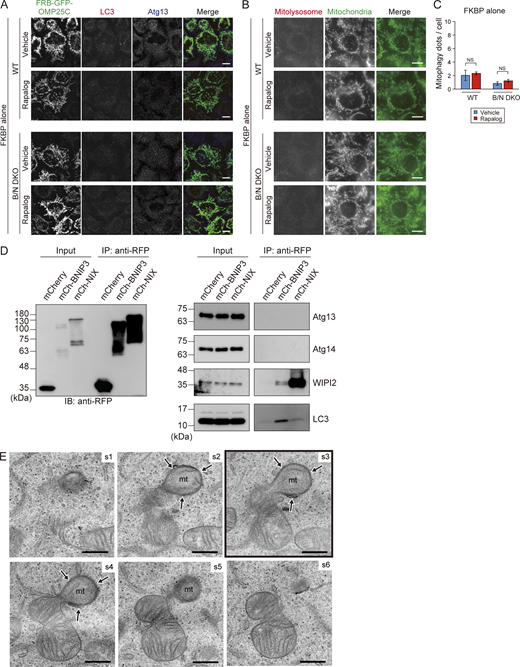 Effects of artificial tethering of the FKBP domain, interaction analysis of BNIP3/NIX with other autophagy factors, and serial ultrathin sections related toFig. 7 G. (A and B) Representative immunofluorescence images of Atg13 and LC3 (A) and mt-Keima (B) in WT and B/N DKO cells, with or without artificial tethering of the FKBP domain to mitochondria. In merged images, mitolysosomes (excited at 590 nm) and mitochondria (excited at 430 nm) are indicated by red and green, respectively. Scale bars: 10 μm. (C) Quantification of the mitolysosomes in the cells shown in B. More than 200 cells were analyzed in each experiment. Data expressed as the means ± SEM of three independent experiments; ***P < 0.001 and not significant (NS), determined by one-way ANOVA followed by a Tukey–Kramer post hoc test. (D) Immunoprecipitation (IP) analysis of mCherry-BNIP3 or mCherry-NIX expressed in B/N DKO cells cultured with DFP for 12 h and then treated for an additional 12 h with 100 nM bafilomycin A1 and DFP. The cells were lysed, and IP was performed using RFP-trap magnetic agarose. Input is 10% of the IP fraction. (E) Serial ultrathin sections of the mitophagy profile. The framed image appears in Fig. 7 G. Section (s) numbers are indicated at the top right corner of each EM image. mt, mitochondrion; arrows, IM. Scale bars: 500 nm. Source data are available for this figure: SourceData FS4. Refer to the image caption for details.