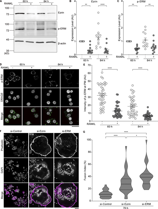Reduction of MCA by RANKL treatment is caused by decreased expression of ezrin. (A) Western blot analysis of cell lysates from RAW 264.7 cells without or with RANKL treatments for the indicated times, using anti-ezrin, anti–p-ERM, and anti–β-actin antibodies. (B and C) Quantification of (A). Mean ± SEM, n = 12 experiments. P value obtained from one-way ANOVA with Tukey’s test. **P < 0.01; ****P < 0.0001. (D) Confocal images of RAW 264.7 cells without or with RANKL for 60 or 84 h, stained with anti–p-ERM antibody (green) and DRAQ5 (gray). Scale bar: 20 μm. (E) Quantification of fluorescence intensity of p-ERM beneath the PM determined by wheat germ agglutinin (WGA) signal. Mean ± SEM, n = 40 cells for each condition. P value obtained from one-way ANOVA with Tukey’s test. ****P < 0.0001. (F) Confocal images of siRNA knockdown cells treated with RANKL for 70 h, stained with phalloidin (magenta) and DAPI (gray). Multinucleated cells are surrounded by dotted lines. Scale bar: 50 μm. (G) Quantification of fusion index in F. Dotted lines in violin plots show median and quantiles. n = 30 fields of view for each condition. P value obtained from one-way ANOVA with Tukey’s test. *P < 0.05; ****P < 0.0001. Source data are available for this figure: SourceData F3.