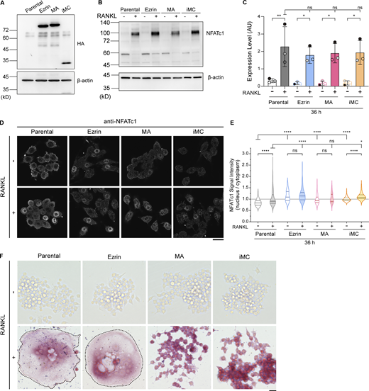 Establishment of cell lines expressing ezrin, MA-ezrin, and iMC-linker, and the expression and localization confirmation of NFATc1, a master transcription factor, and TRAP, an osteoclast differentiation marker. (A) Representative western blot of parental cells and stable cell lines overexpressing HA-tagged ezrin, MA-ezrin (MA), and iMC-linker (iMC) without RANKL treatment, using anti-HA tag and anti–β-actin antibodies. (B) Representative western blot of parental cells and stable cell lines above without or with RANKL treatment for 36 h, using anti-NFATc1 and anti–β-actin antibodies. (C) Quantification of B. Mean ± SEM, n = 3 experiments. Note that overexpression of these exogenous genes does not inhibit the induction of NFATc1 expression induced by RANKL. P value obtained from one-way ANOVA with Tukey’s test. ns: not significant; *P < 0.05; **P < 0.01. (D) Confocal images of the four cell lines above without or with RANKL treatment for 36 h, stained with anti-NFATc1 antibody. Scale bar: 20 μm. (E) The nucleus-to-cytoplasm ratio of NFATc1 signal intensity in mononuclear cells. Solid and dotted lines in violin plots show median and quantiles. The total number of cells analyzed was as follows: n = 224 (parental, RANKL−), 197 (parental, RANKL+), 153 (ezrin, RANKL−), 200 (ezrin, RANKL+), 141 (MA, RANKL−), 117 (MA, RANKL+), 288 (iMC, RANKL−), and 304 (iMC, RANKL+). P value obtained from one-way ANOVA with Tukey’s test. ns: not significant; *P < 0.05; ****P < 0.0001. Note that the nucleus-to-cytoplasm ratios of these stable cell lines tend to be higher compared with parental cells; however, they do not inhibit the nuclear transport of NFATc1. (F) The four cell lines stained for TRAP activity. Multinucleated cells are surrounded by dotted lines. Note that all cell lines indicate the activity of TRAP after RANKL treatment for 84 h. Scale bar: 200 μm. Source data are available for this figure: SourceData FS2.