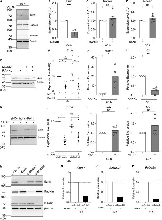 Ezrin is the only ERM family protein whose expression is reduced by RANKL treatment, and its expression is regulated at the transcriptional level. (A) Western blot analysis of cell lysates without or treated with RANKL for 60 h using anti-ezrin, anti-radixin, anti-moesin, and anti–β-actin antibodies. (B–D) Quantification of endogenous ezrin (B), radixin (C), and moesin (D) based on (A). Mean ± SEM, n = 6 experiments. P value obtained from two-tailed Student’s t test. ns: not significant; ****P < 0.0001. (E) Western blot analysis of cell lysates without or treated with RANKL and the proteasome inhibitor MG132 for 84 h using anti-ezrin and anti–β-actin antibodies. (F) Quantification of endogenous ezrin based on E. The values of each band were measured and normalized to cells not treated with RANKL and MG132. Mean ± SEM, n = 6 experiments. P value obtained from one-way ANOVA with Tukey’s test. ns: not significant; *P < 0.05; **P < 0.01. (G–J) qPCR analysis of the relative expression of Nfatc1 (G), Ezr (H), Rdx (I), and Msn (J). mRNA was extracted after 60 h of RANKL treatment and normalized to the expression of Gapdh mRNA. Mean ± SEM, n = 4 experiments. P value obtained from two-tailed Student’s t test. ns: not significant; *P < 0.05; ***P < 0.001. (K) Western blot analysis of Blimp1 knockdown cell lysates without or treated with RANKL for 84 h using anti-ezrin and anti–β-actin antibodies. (L) Quantification of endogenous ezrin based on K. The values of each band were measured and normalized to cells not treated with RANKL of si-Control group. Mean ± SEM, n = 7 experiments. P value obtained from one-way ANOVA with Tukey’s test. ns: not significant; *P < 0.05; ****P < 0.0001. (M) Representative western blot of siRNA knockdown cells with RANKL treatments for 70 h, using anti-ezrin, anti-radixin, anti-moesin, and anti–β-actin antibodies. (N–P) qPCR analysis of the relative expression of Fnbp1 (N) and Baiap2l1 (72 h, O; 84 h, P) mRNAs, normalized by that of Gapdh mRNA. Source data are available for this figure: SourceData FS3.