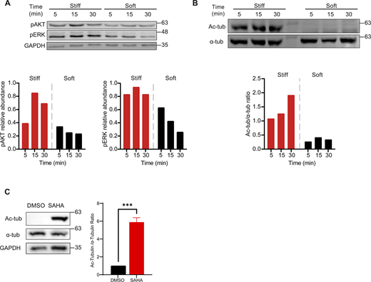 B cells activated on stiff substrates display enhanced BCR signaling and microtubule acetylation. (A and B) Top: Western blot of B cells activated on soft and stiff surfaces for different time points to measure pAKT, pERK, and GAPDH (A), or Ac-Tub (B). Bottom: Quantifications of the relative abundance of pAKT and pERK with respect to GAPDH (A) or Ac-Tub with respect to total tubulin (B). (C) Western blot analysis of Ac-Tub levels in B cells treated with SAHA. Representative immunoblots showing the expression of Ac-Tub, total α-Tub, and GAPDH as a loading control in vehicle (DMSO) and SAHA-treated B cells. The quantification (right) represents the ratio of Ac-Tub to total α-Tub, normalized to the DMSO condition. t test. P values illustrated with asterisks are * <0.05. Source data are available for this figure: SourceData FS2. Refer to the image caption for details.