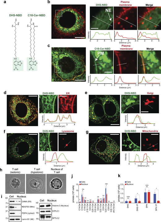 LCBs are integral components of the nuclear membrane in human cells. (a) Chemical structure of the fluorescent probes used in our studies. DHS, dihydrosphingosine; Cer, ceramide; NBD, nitrobenzoxadiazole. (b) Live-cell microscopy of HeLa cells expressing mCherry-Farnesyl-5 (red, plasma membrane) and incubated with 1 µM DHS-NBD (green) for 20 min. Scale bar in the left image, 10 µm, and in zoomed images, scale bar, 2 µm. NE indicates NE. Fluorescence intensity across the white dotted lines is shown below. (c) Live-cell microscopy of HeLa cells expressing mCherry-Farnesyl-5 and incubated with 1 µM C18-Cer-NBD (green) for 20 min. Scale bar in the left image, 10 µm; in zoomed images, scale bar, 2 µm. PM, plasma membrane. Fluorescence intensity across the white dotted lines is shown below. (d–g) Live-cell microscopy of HeLa cells incubated with 1 µM DHS-NBD (green) for 20 min. In d, cells express Sec61-mCherry (NE and ER); in e, cells express mCherry-Golgi-7 (Golgi apparatus); in f, cells express LAMP1-mCherry (lysosome); and in g, cell express mCherry-mito-7 (mitochondria). Scale bar in the left image, 10 µm; in zoomed images, scale bar, 2 µm. Fluorescence intensity across the white dotted lines is shown below. (h) DIC images of a T cell and purified nucleus. Scale bar, 2 µm. (i) Western blot analysis of the different organelle markers in whole-cell extracts and isolated nuclei from T cells. (j and k) HPLC-MS/MS analysis of ceramides (j) and LCBs (k) of primary T cells and isolated nuclei from the T cells. Error bars represent standard deviations (n = 3 independent samples from human blood, >106 cells or nuclei analyzed per sample). *P < 1e-4, unpaired t test. NS, P value >0.05. HPLC-MS/MS, high-performance liquid chromatography–tandem mass spectrometry. Source data are available for this figure: SourceData F5. Refer to the image caption for details.