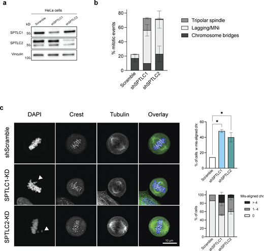 Lack of LCB causes genomic instability. (a) Western blot of SPT subunits in HeLa cells upon their knockdown. (b) Quantification of mitotic events in HeLa cells upon SPTLC1 or SPTLC2 knockdowns. Error bars represent the standard deviation of three biological replicates. (c) Representative images highlighting chromosome missegregation events in HeLa cells upon knockdown of SPTLC1 or SPTLC2. Quantification of the phenotypes is shown on the right. Source data are available for this figure: SourceData FS5. Refer to the image caption for details.
